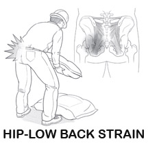 Hip-Low back injury can occur lifting a heavy baga from the ground